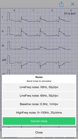 医用心电信号发生器 - ECG Simulator截图3